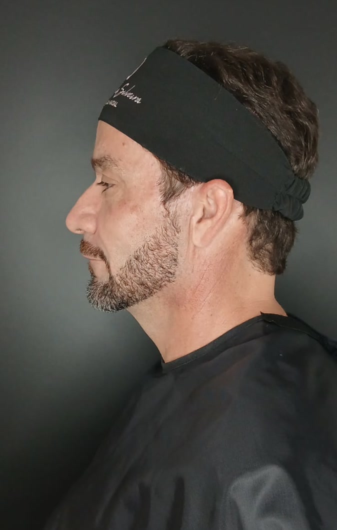 Antes do rejuvenescimento masculino, vista do outro perfil